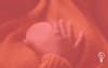 Orb